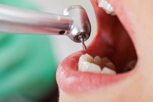 Best Emergency Denture Repair in Paducah, TX
